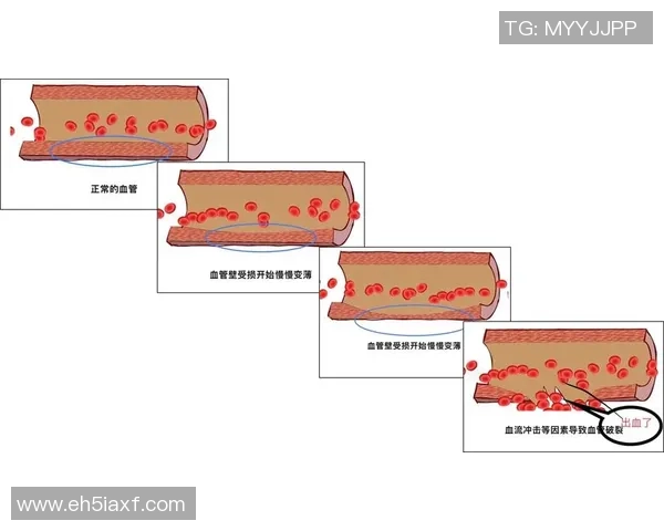 踢足球时意外受伤出血的原因与预防措施探讨 踢足球时意外受伤出血的原因与预防措施探讨